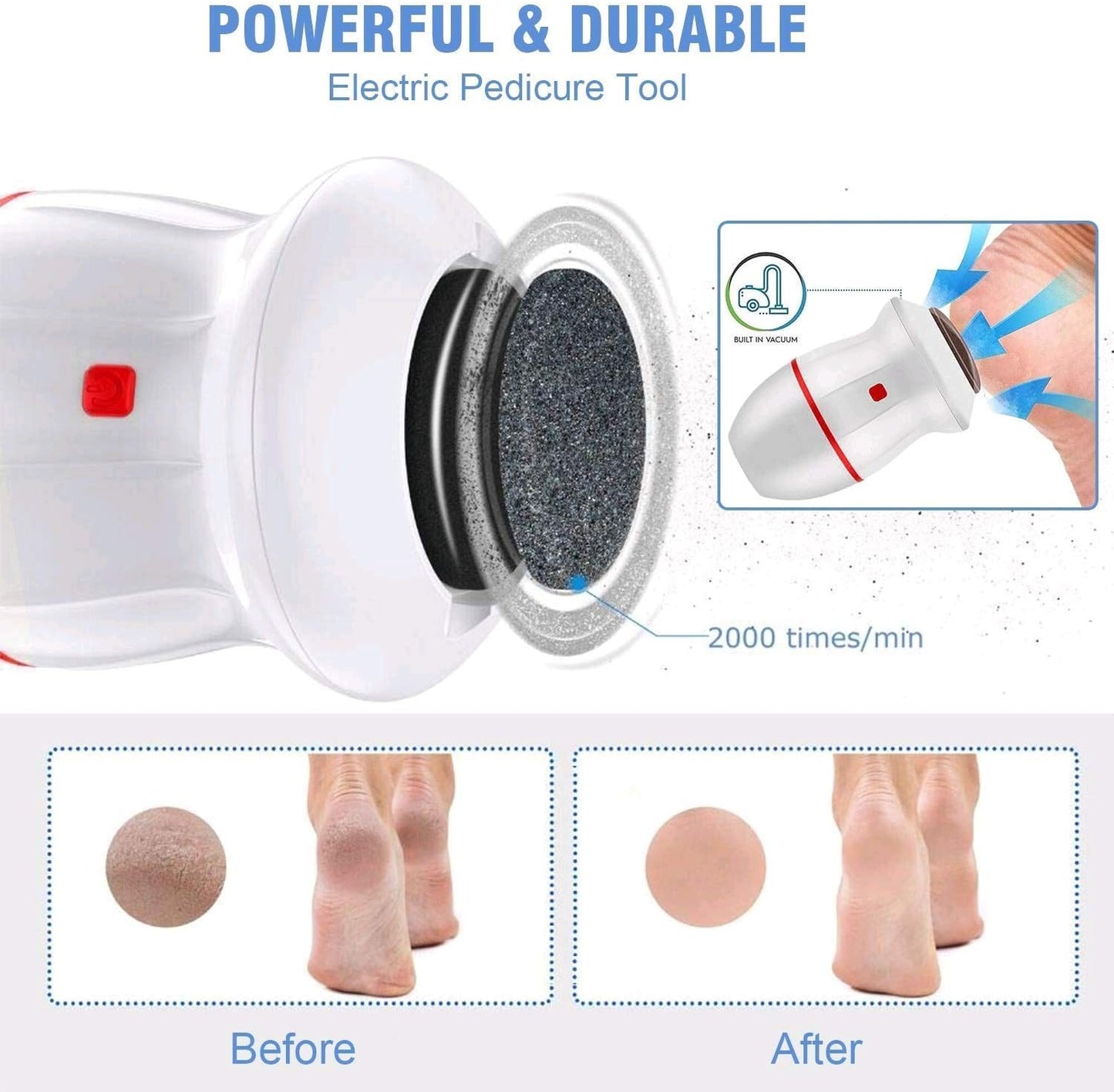 Callus Remover - مكنة حف القدمين