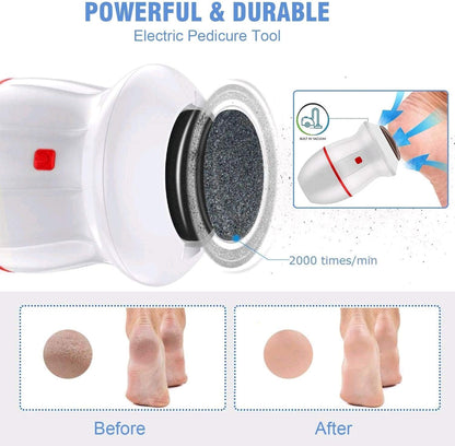 Callus Remover - مكنة حف القدمين