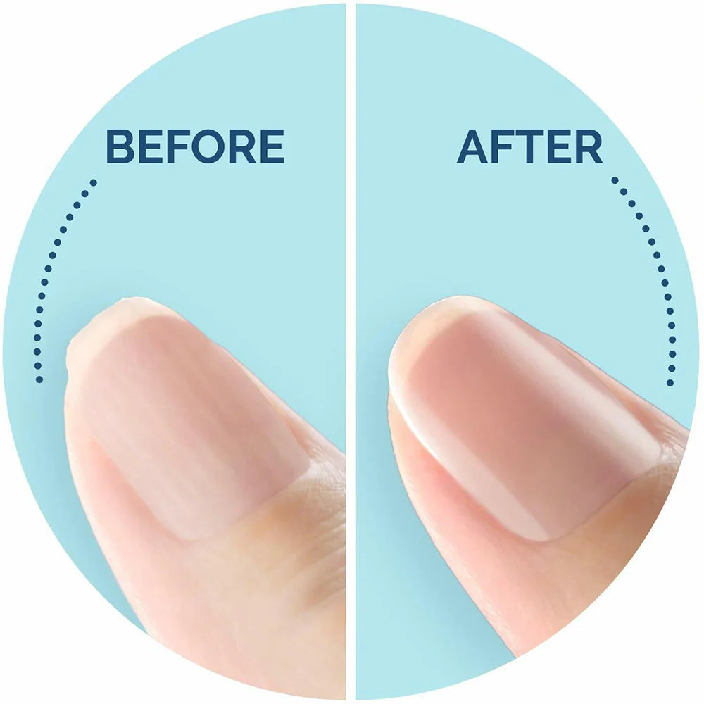 Nail Care Pen - جهاز برد الأظافر